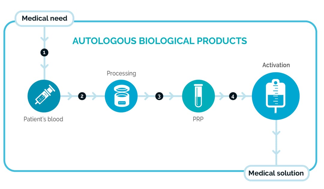 PRP Process